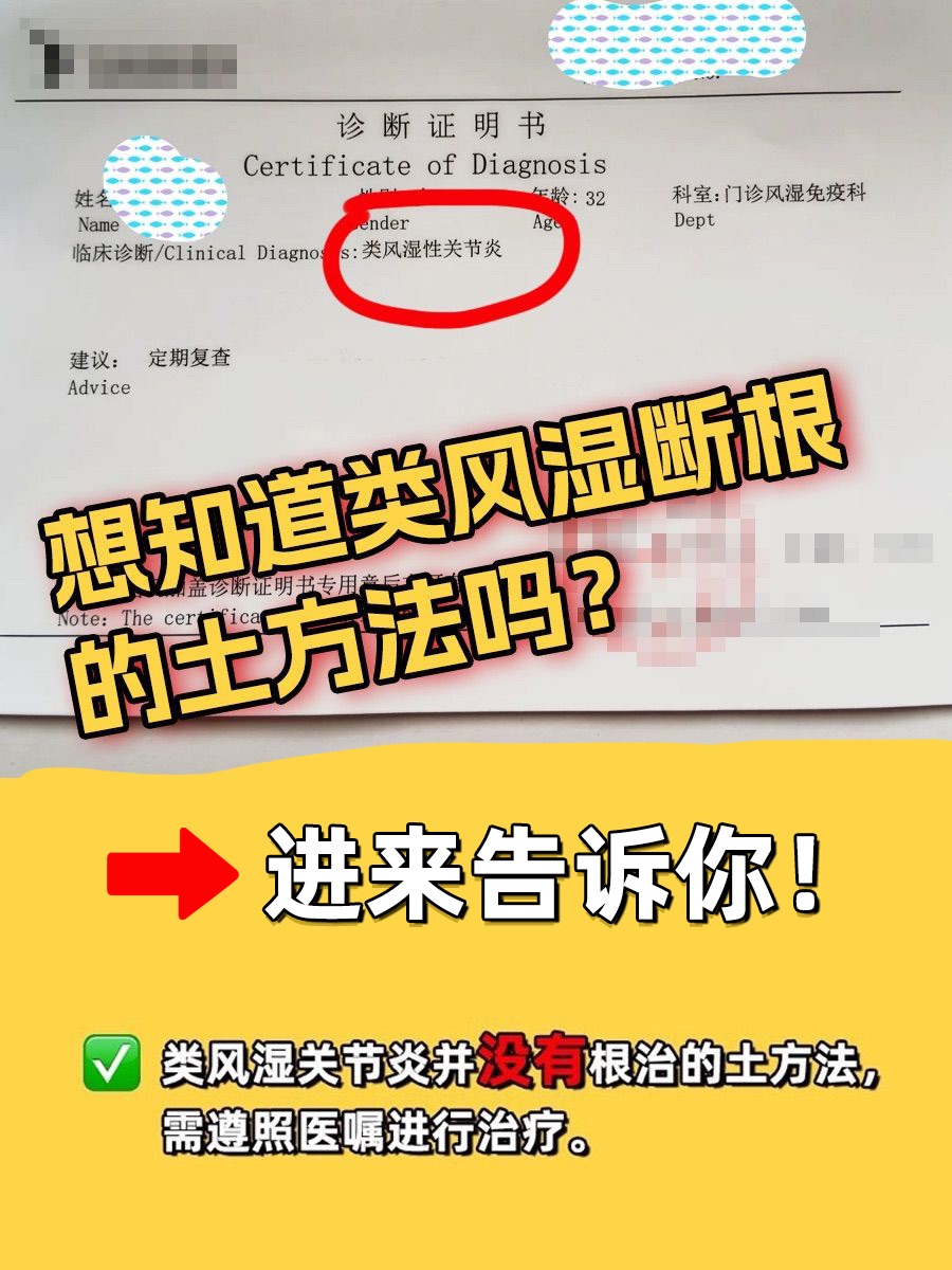 想知道类风湿断根的土方法吗?进来告诉你!