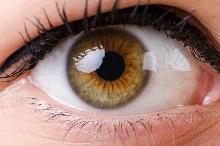 正常瞳孔图