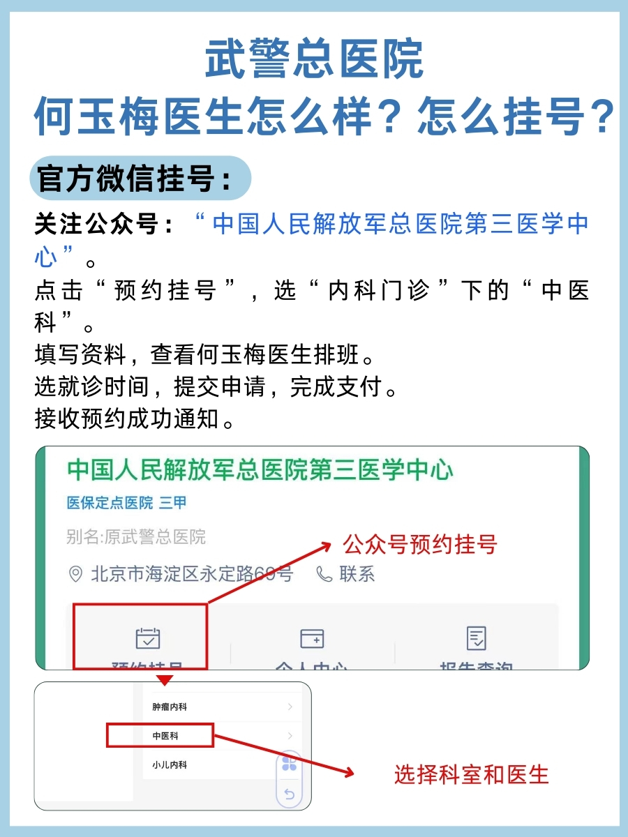 武警总医院何玉梅医生怎么样?怎么挂号?