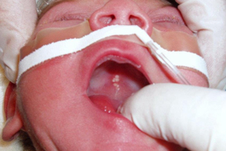 马牙口腔症状图