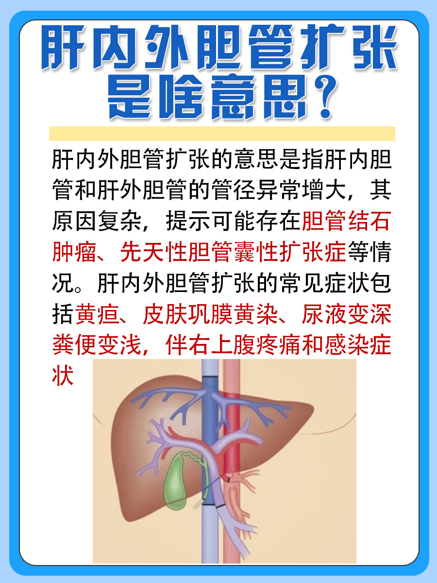 解析：肝内外胆管扩张是什么意思？