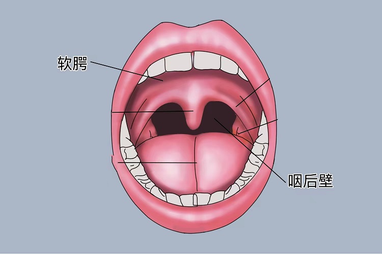 儿童正常咽后壁图