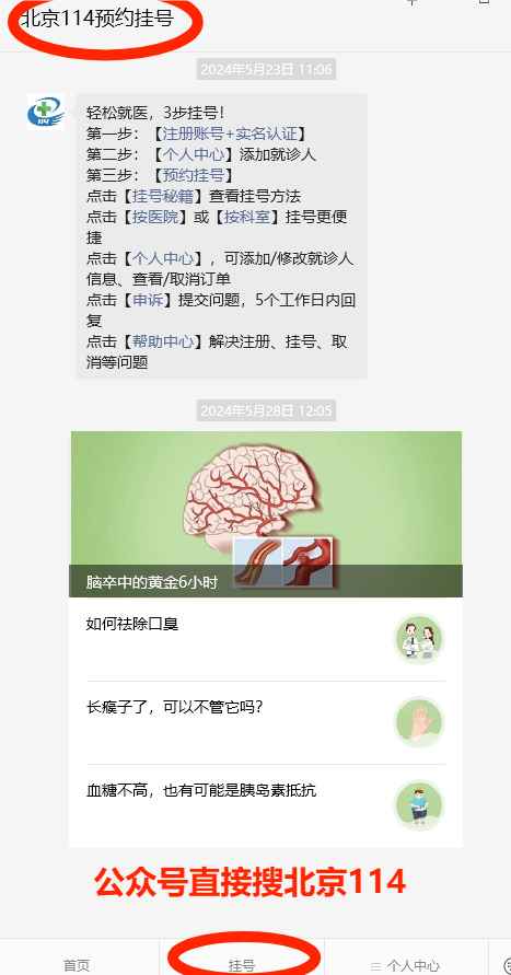 北京协和医院张晓阳医生怎么样?怎么挂号?