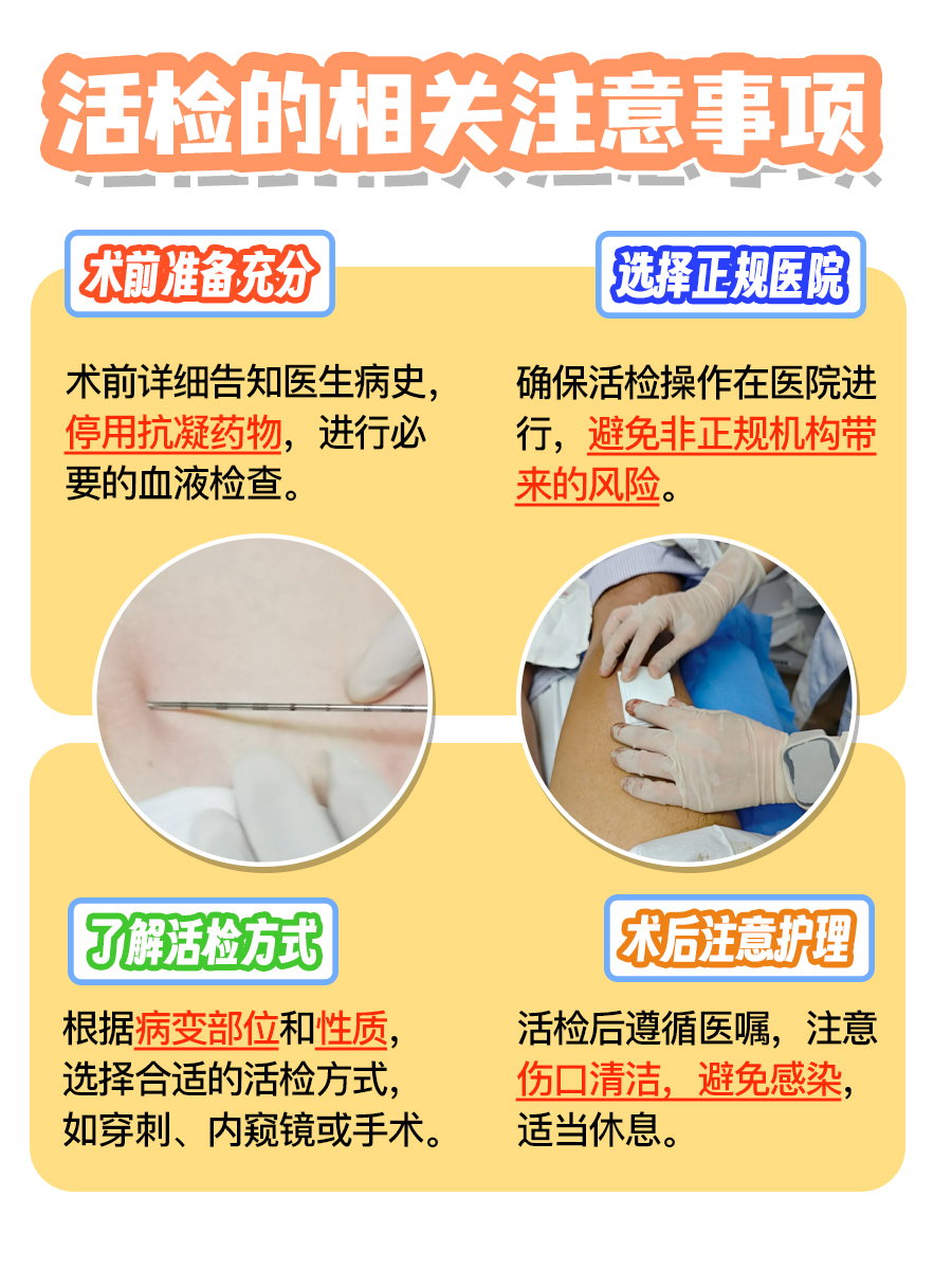 一文读懂活检：怎么做？要花多少钱？