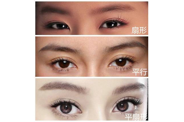 平扇形双眼皮图