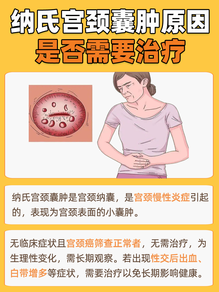 听专家解答，纳氏宫颈囊肿原因，是否需要治疗