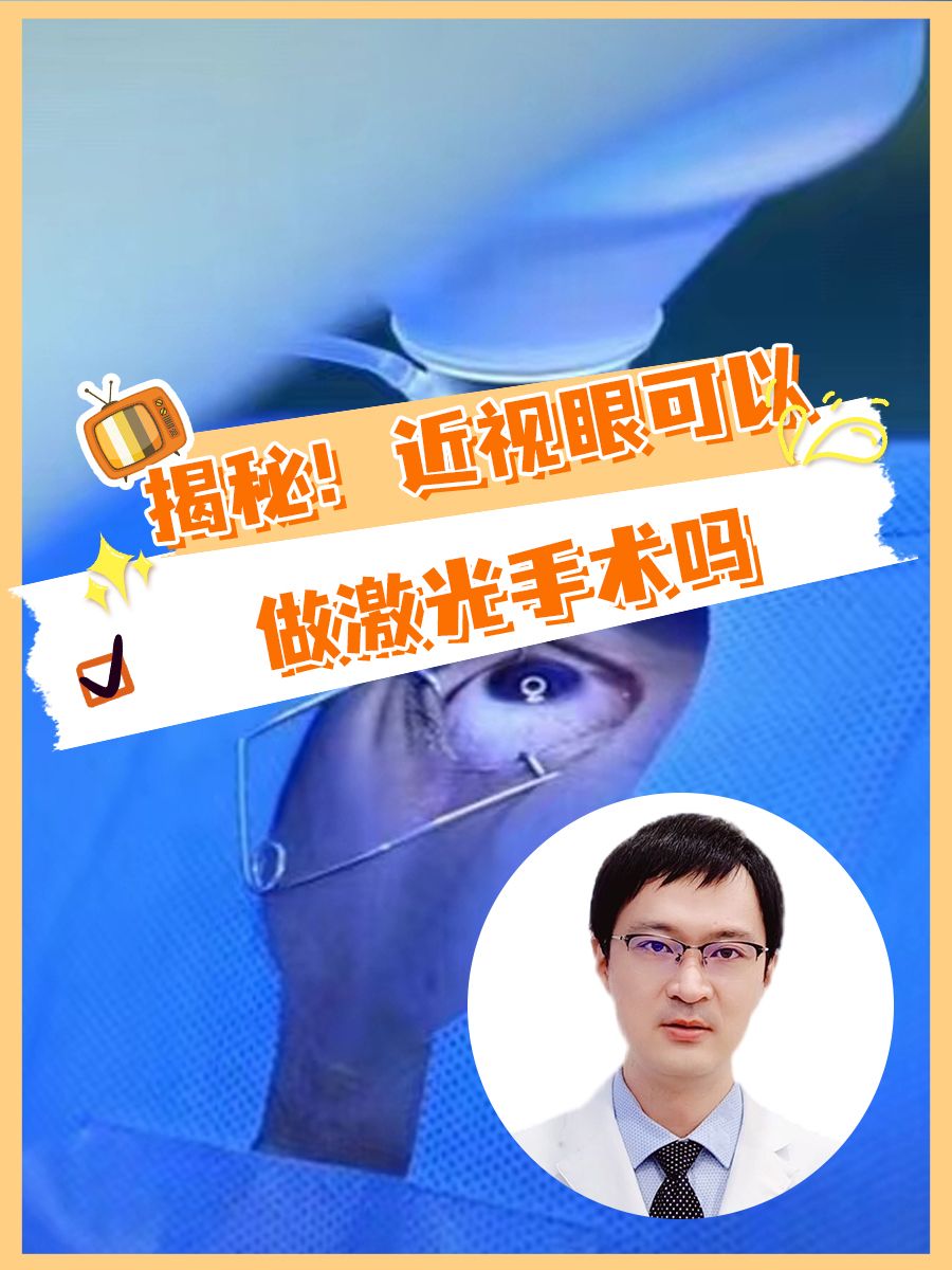 揭秘!近视眼可以做激光手术吗