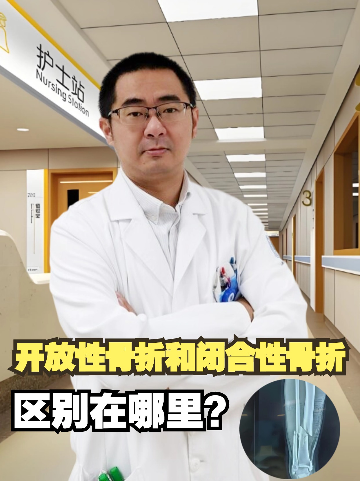 开放性骨折和闭合性骨折，区别在哪里？