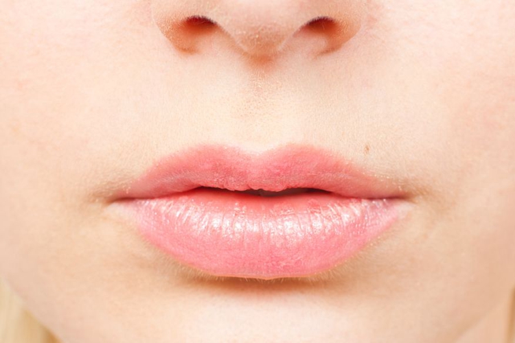 激光脱唇毛效果图