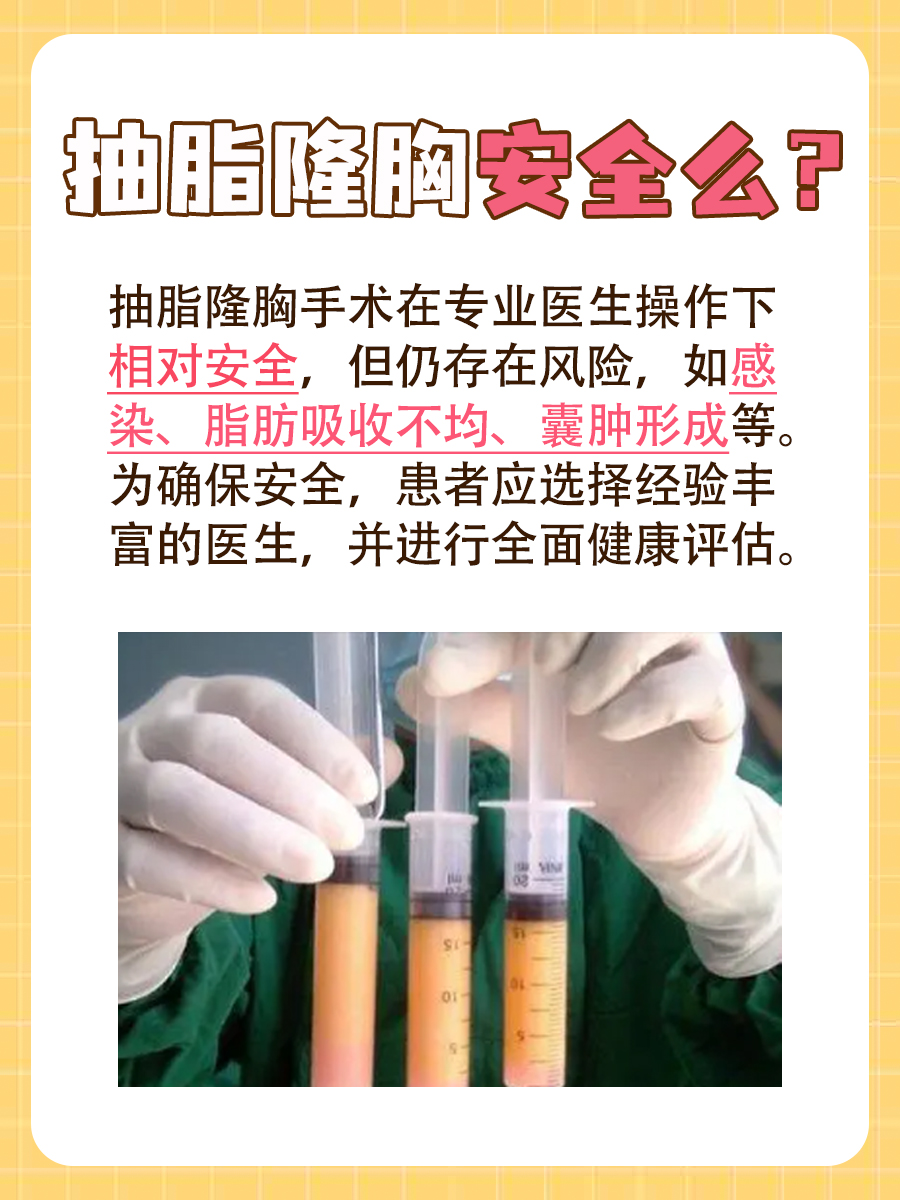 抽脂隆胸安全么,这里有答案!