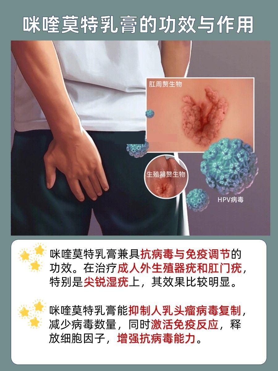 咪喹莫特乳膏功效与作用解析：疣体的强劲对手！