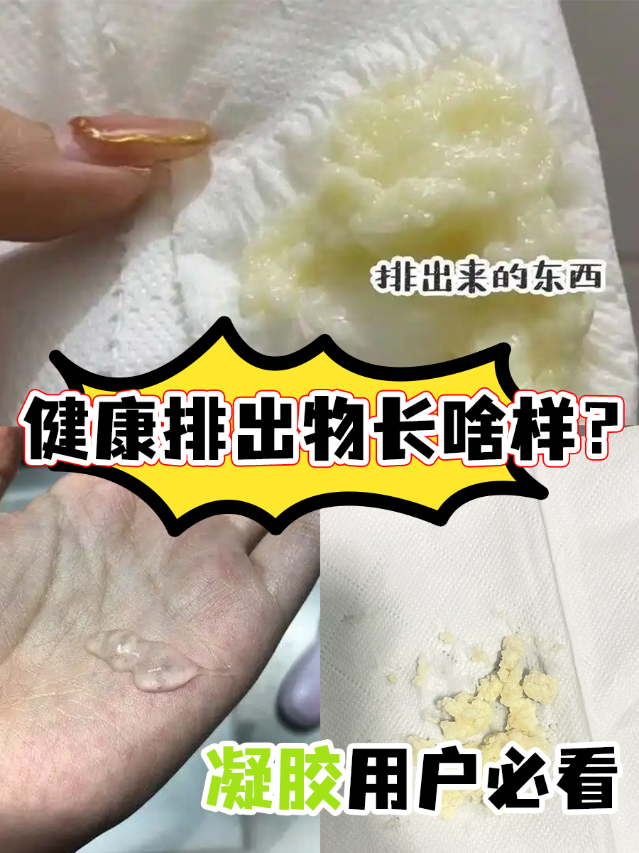 健康排出物长啥样?凝胶用户必看