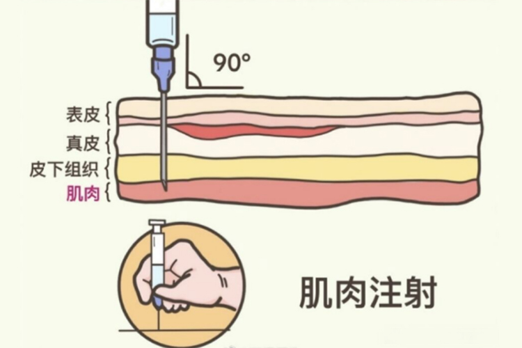 肌肉注射图