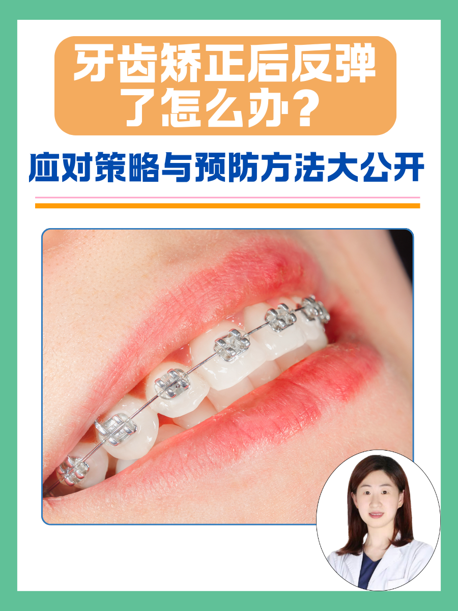 牙齿矫正后反弹了怎么办？应对策略与预防方法大公开