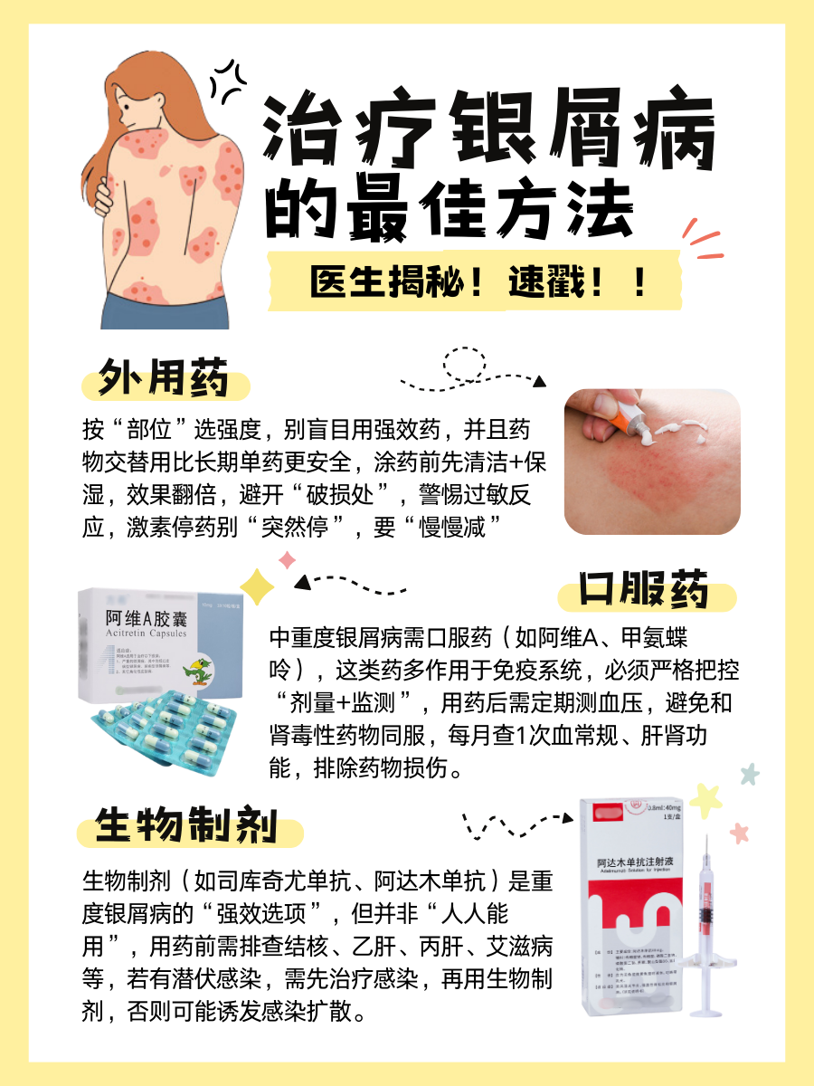 治疗银屑病的最佳方法，医生揭秘！速戳！！