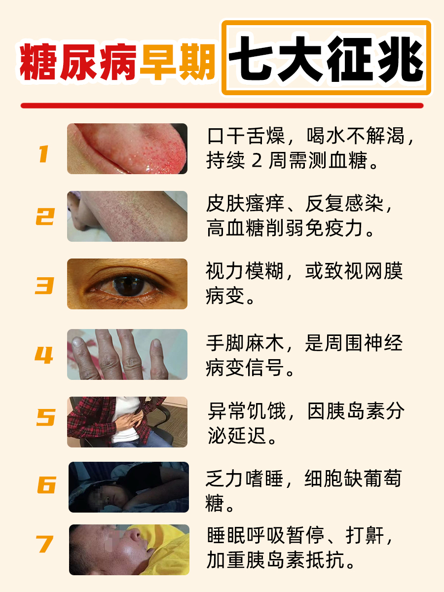 糖尿病早期七大征兆｜中医教你“未病先防”