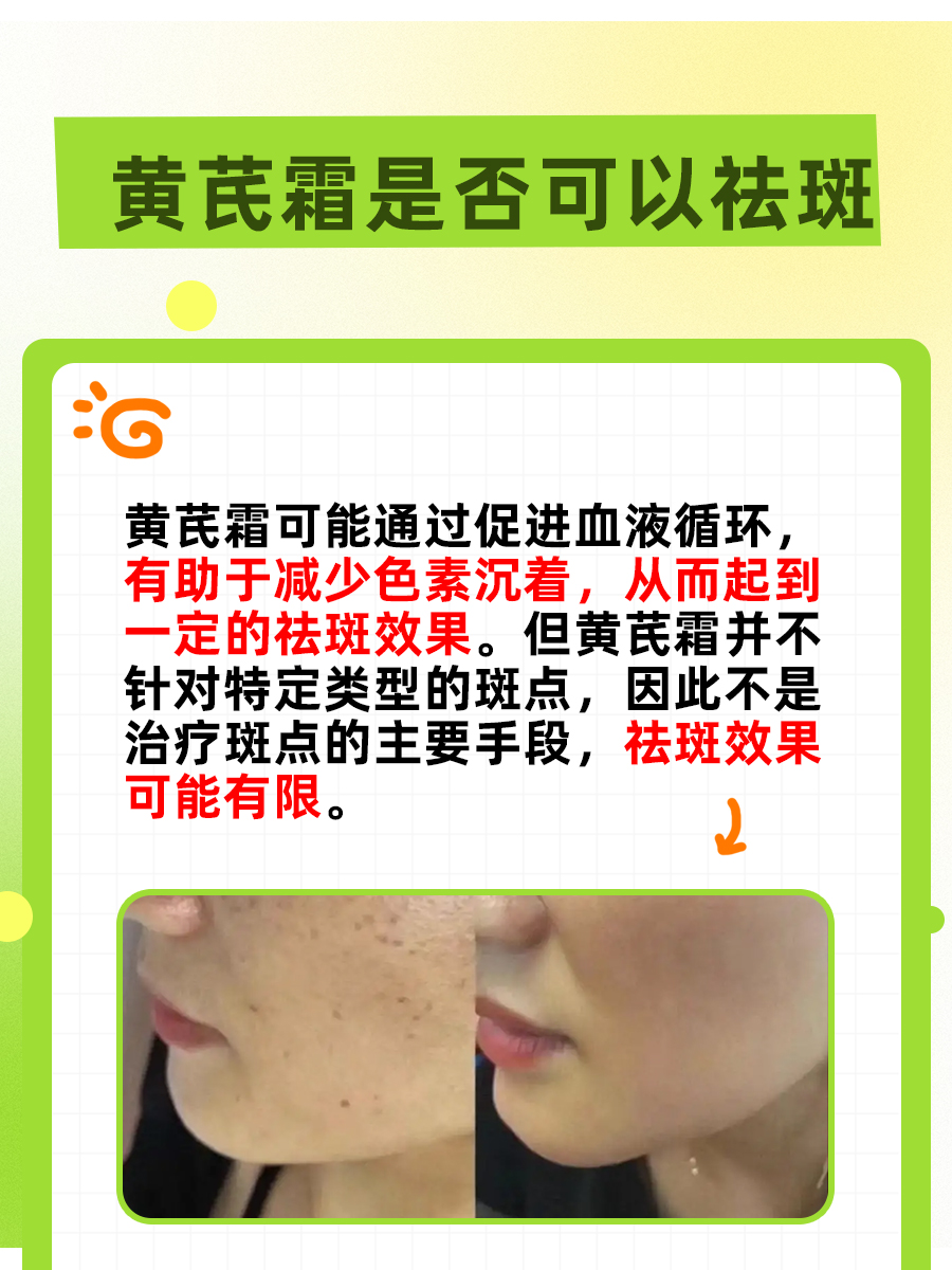 黄芪霜能否祛斑？探索黄芪霜的淡斑效果