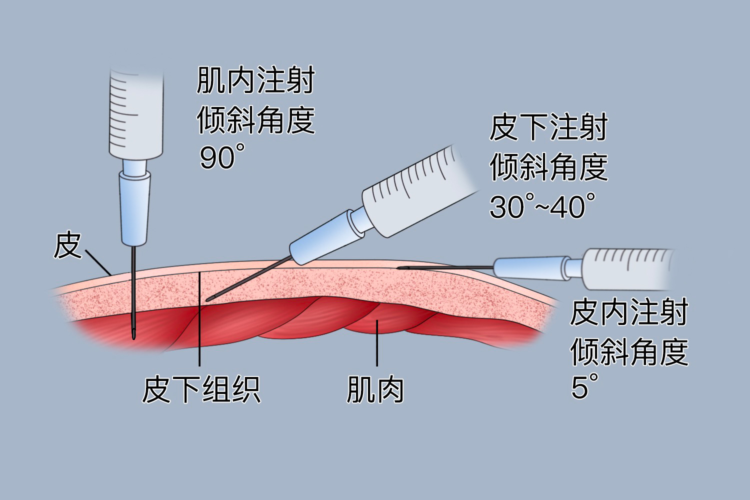 流感疫苗进针角度图