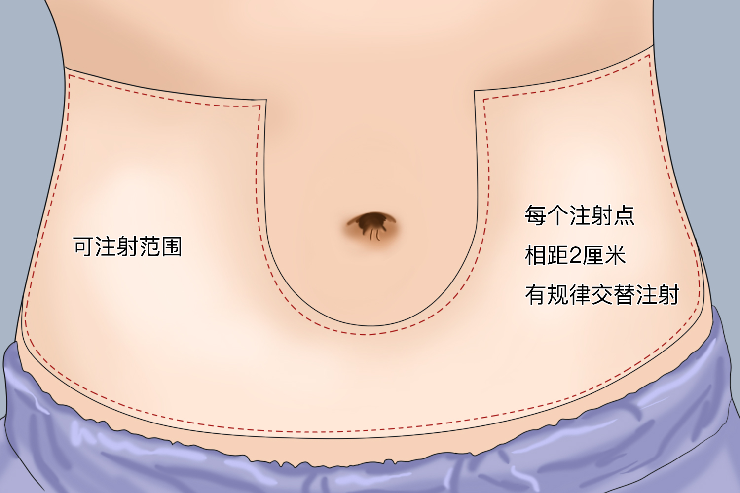 打肝素的肚皮位置图