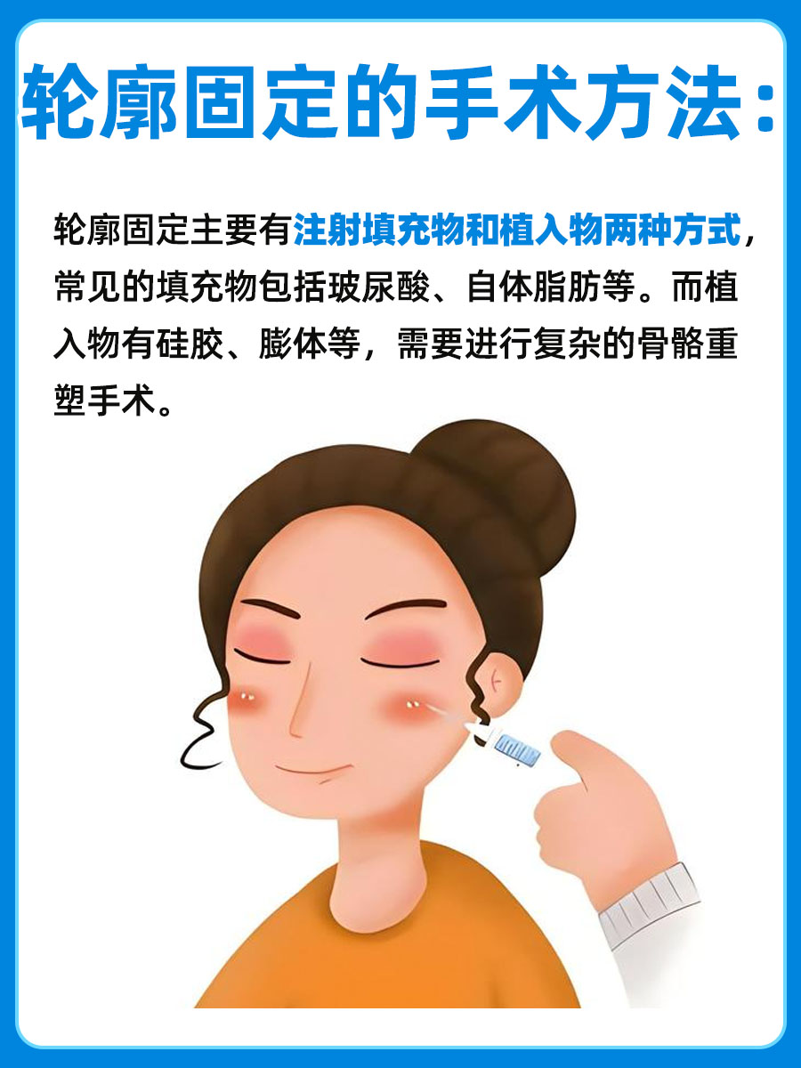 轮廓固定过程如何？价格多少？带你了解