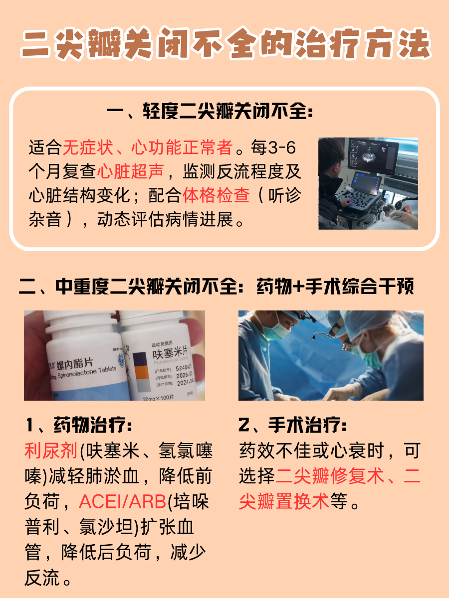 二尖瓣关闭不全怎么治？选对方法才关键！