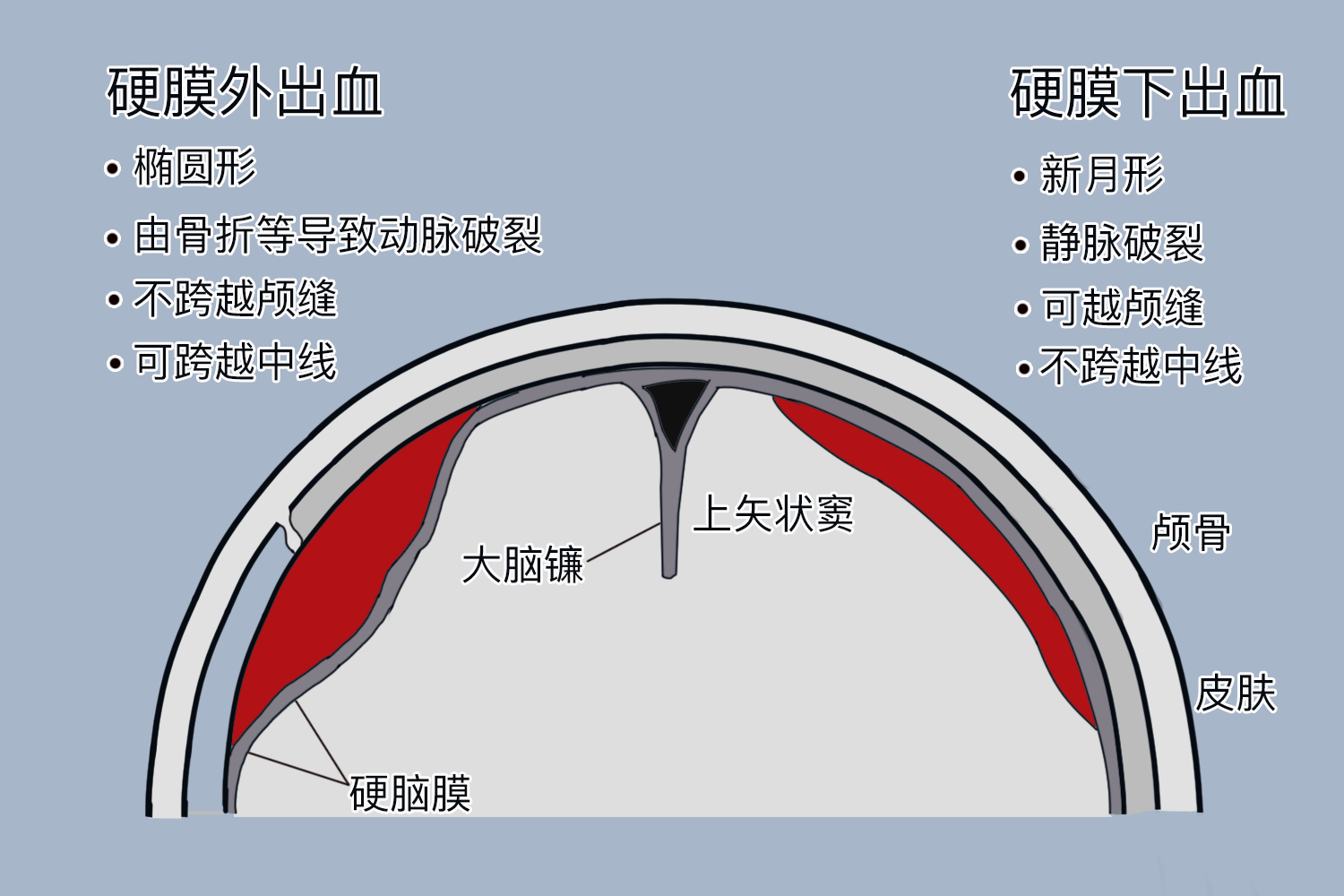硬膜外血肿和硬膜下血肿区别图 硬膜外血肿和硬膜下血肿区别图