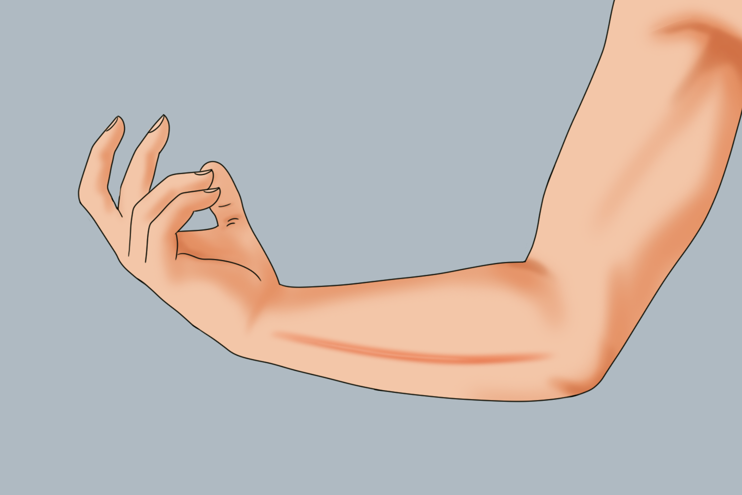 手臂上人工性荨麻疹图 手臂上人工性荨麻疹图