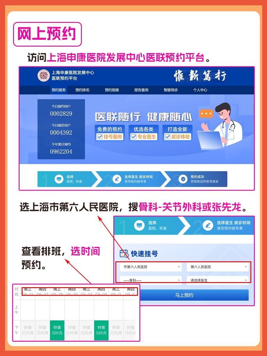 上海市第六人民医院张先龙医生怎么样?怎么挂号?