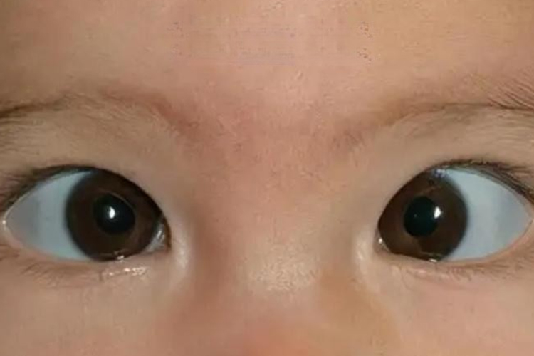 宝宝眼睛内聚图