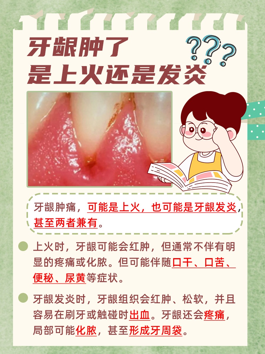医生解析牙龈肿痛原因：上火还是牙龈发炎？