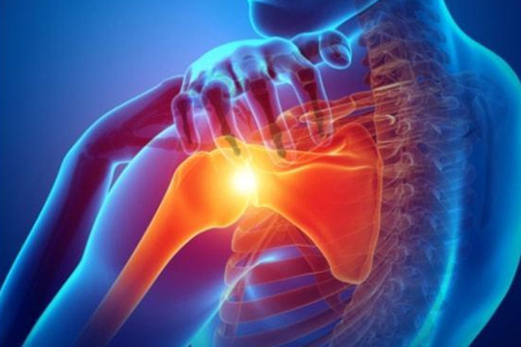 肩周炎疼痛位置解剖图