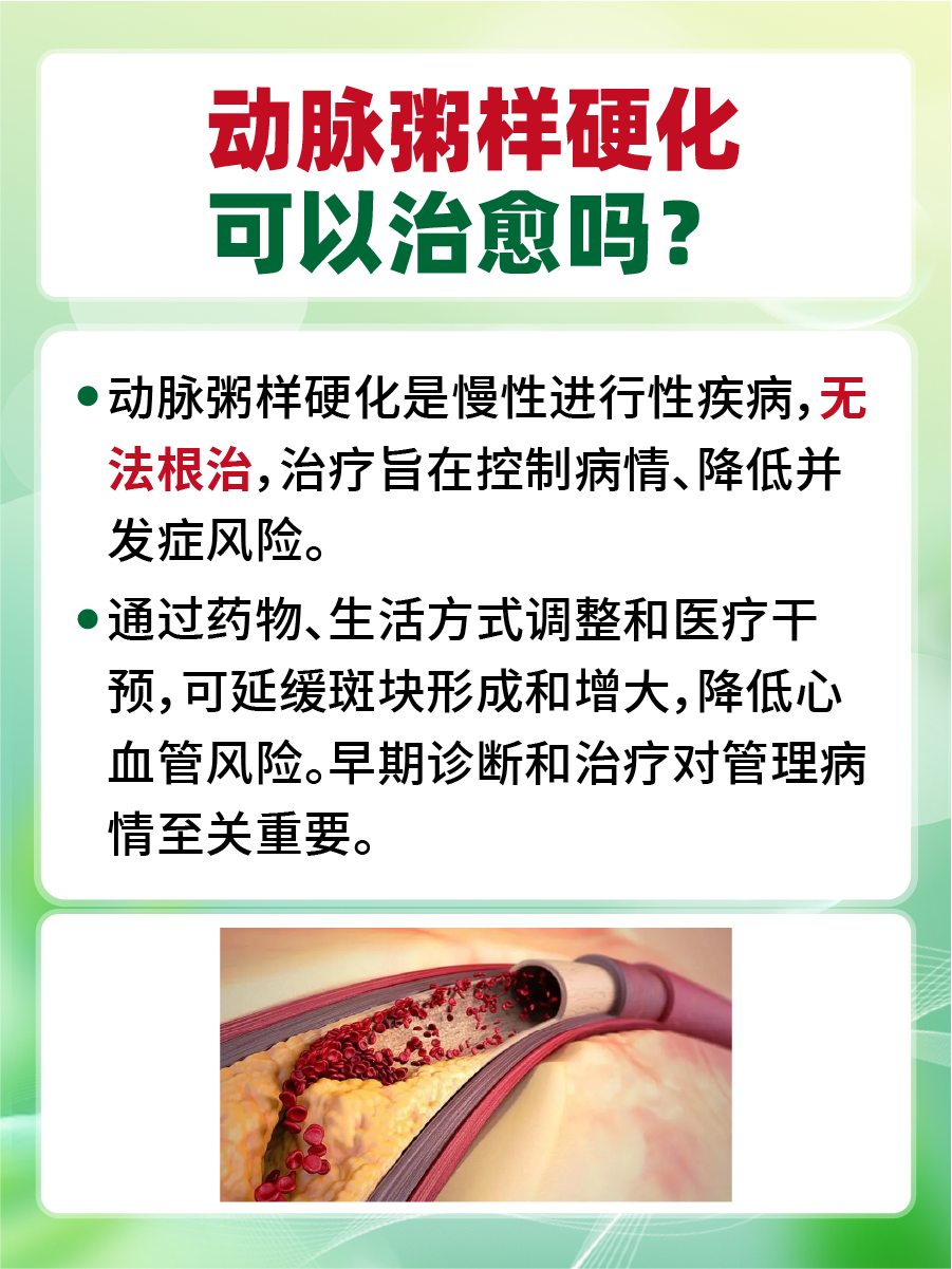 一文了解：动脉粥样硬化可以治愈吗？