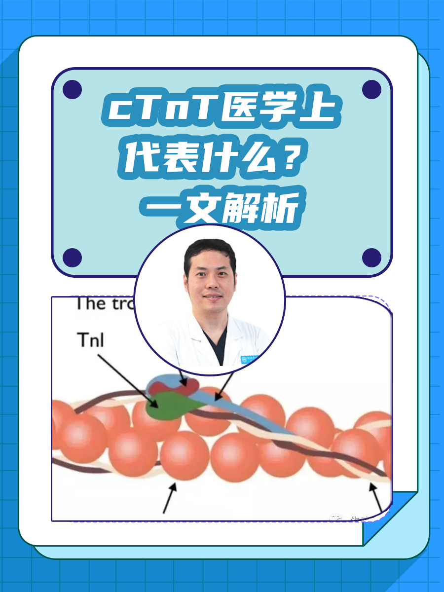 cTnT医学上代表什么？一文解析