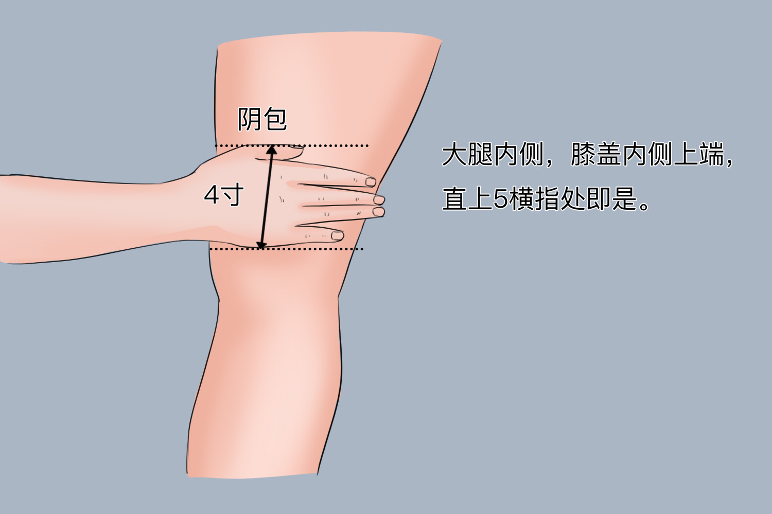 阴包位置示意图