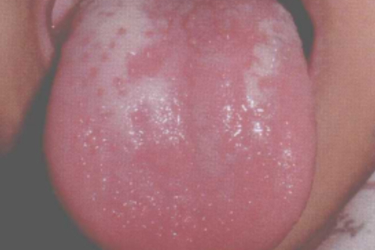 花剥苔图 花剥苔图