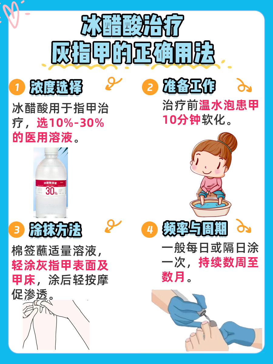 冰醋酸治疗灰指甲的正确用法与科学治疗探索