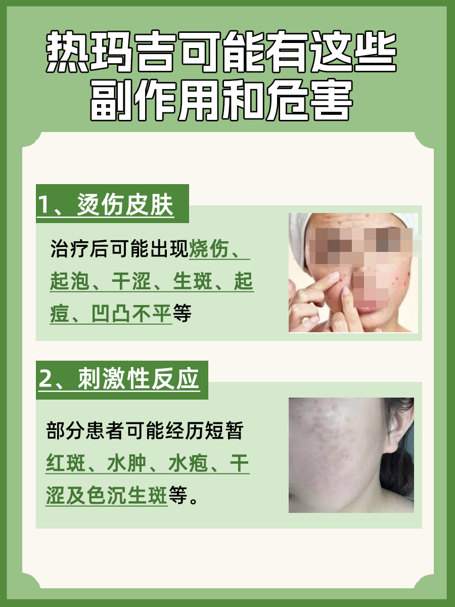 医生揭秘：热玛吉的副作用和危害