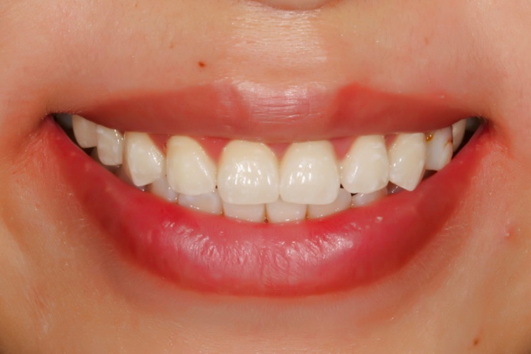 正常人的嘴唇图