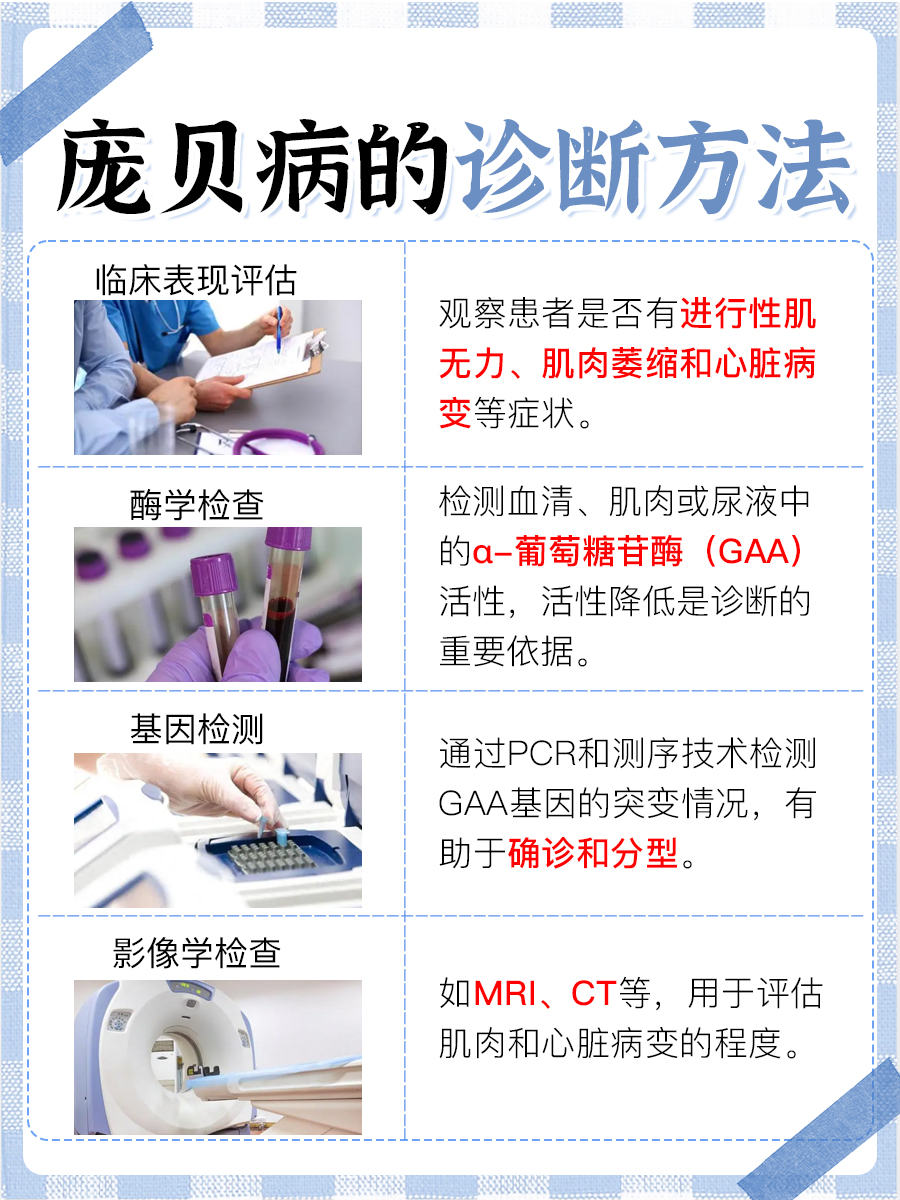 庞贝病：治疗现状与希望