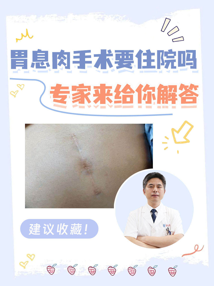 胃息肉手术要住院吗,专家来给你解答