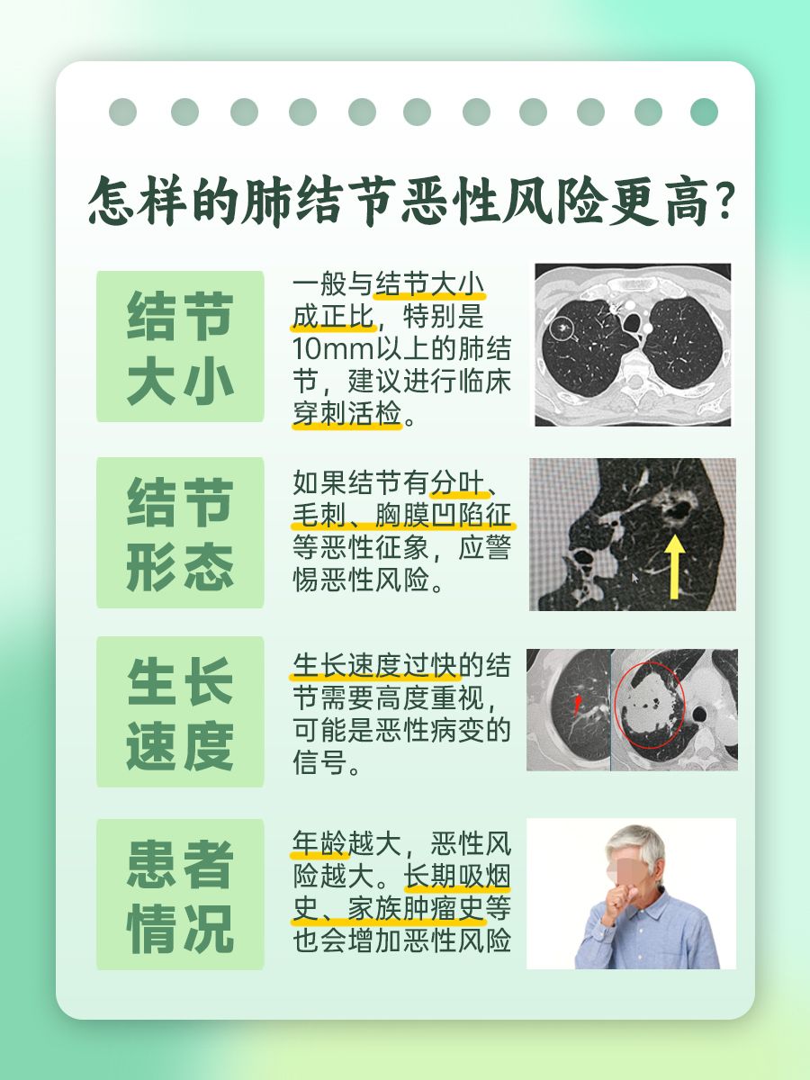 肺结节IM值大好还是小好？了解一下！