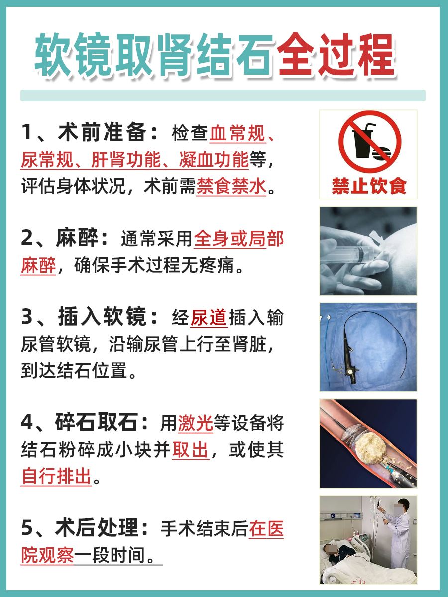 医生解答:软镜取肾结石全过程