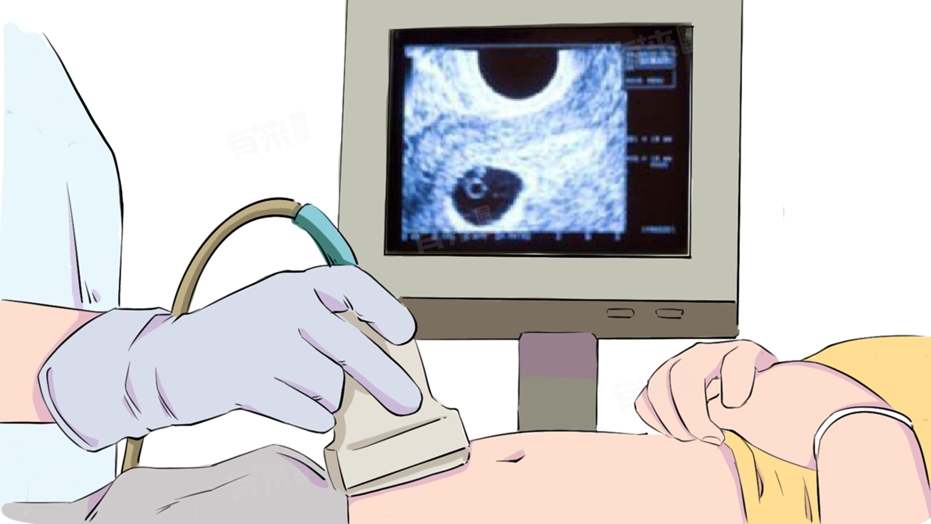 孕期频繁做B超对胎儿有没有影响-有来医生