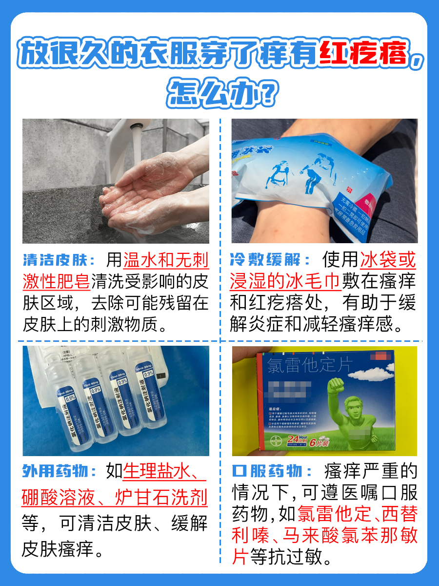 久放衣物穿上身,为何皮肤痒起红疙瘩?