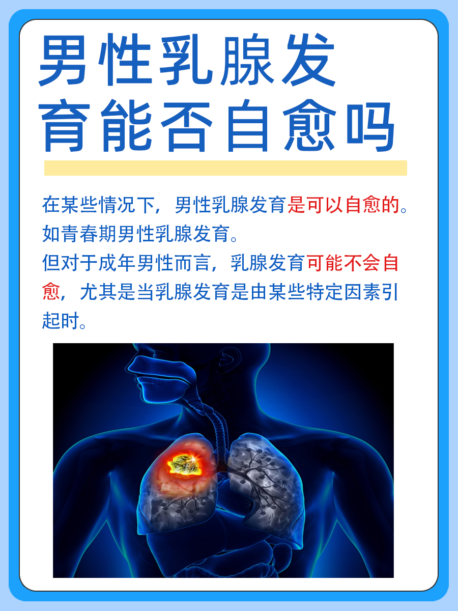 男性乳腺发育：自然恢复的可能性探讨