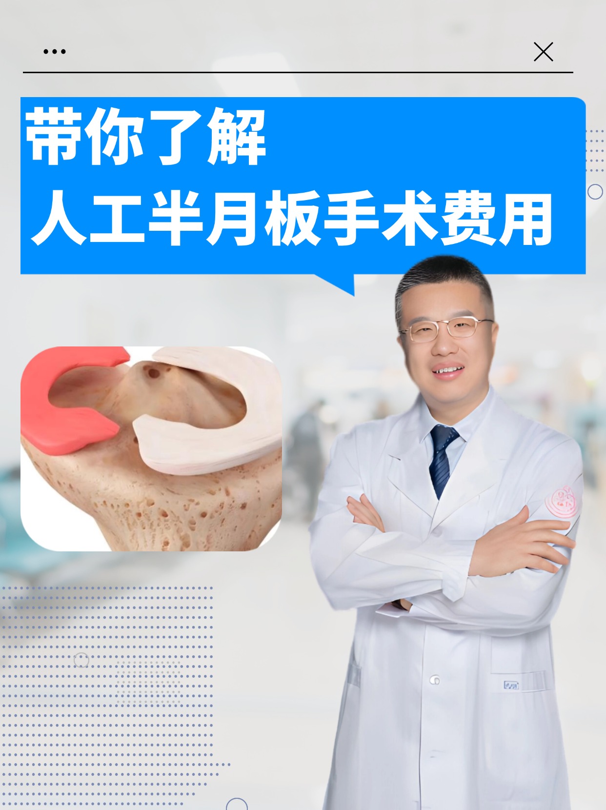 带你了解,人工半月板手术费用