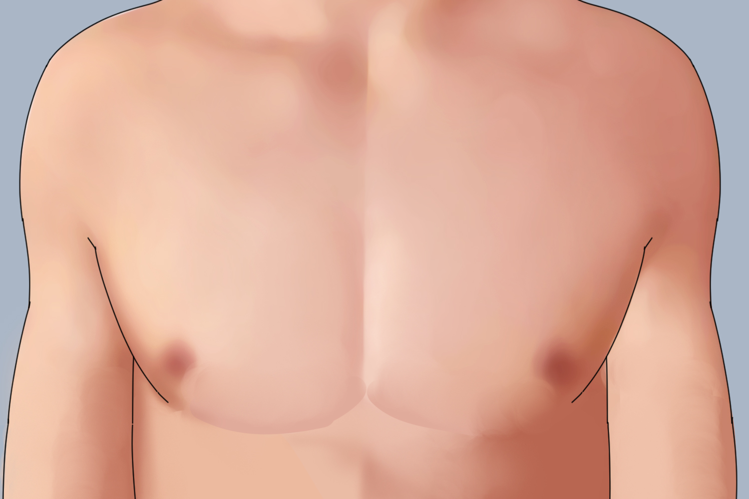 男孩乳房发育生理现象图 男孩乳房发育生理现象图