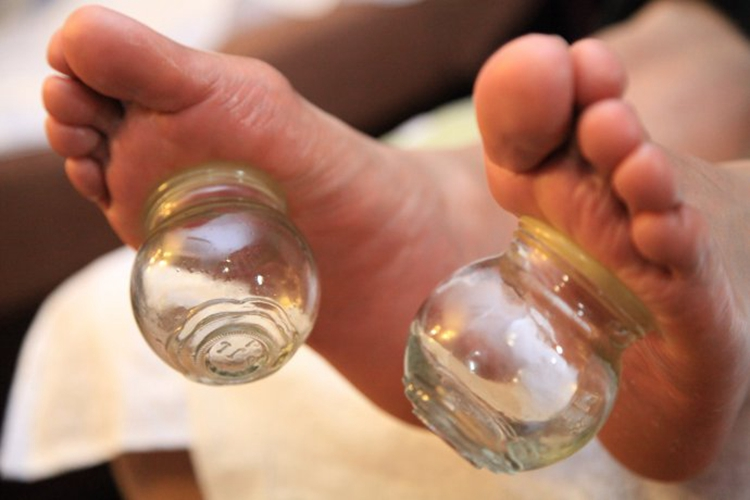 涌泉穴位置拔罐图