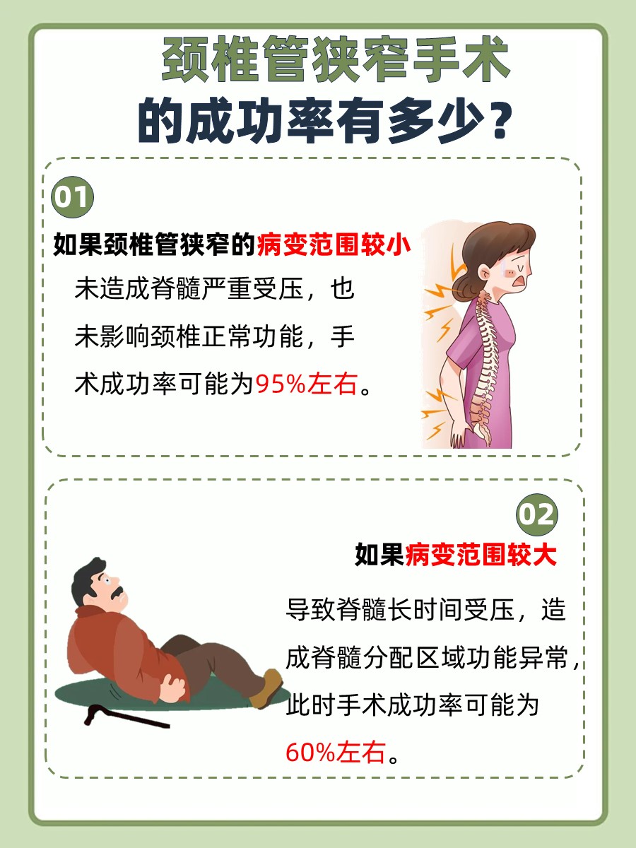 颈椎管狭窄手术成功率：医生带你一探究竟