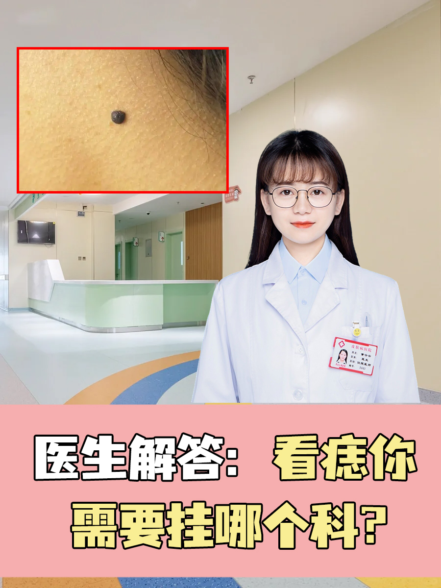 医生解答：看痣你需要挂哪个科？